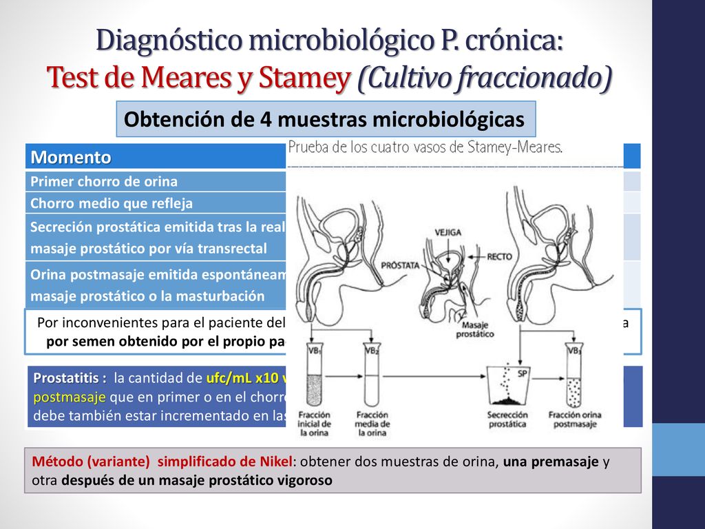 cultivo de secreción de próstata como se hace